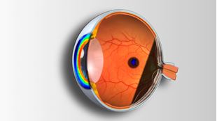 Picture for category Course in Complementary Exam Techniques and Ocular Pathology
